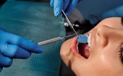 How to Select a Cosmetic Dentist: Everything You Need to Know