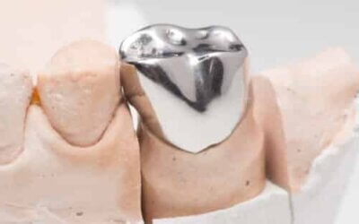 Understanding the Different Types of Dental Crowns