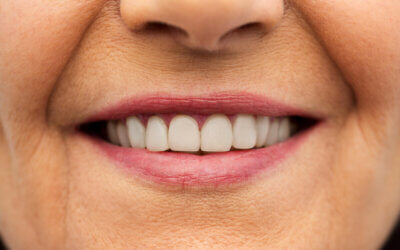 8 Dental Issues a Jacksonville, FL Veneers Dentist Can Fix