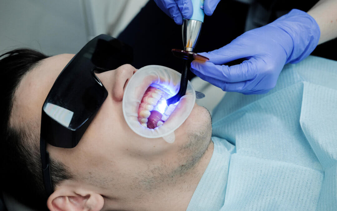 Top Questions to Ask Your Implant Dentist in Jacksonville, FL