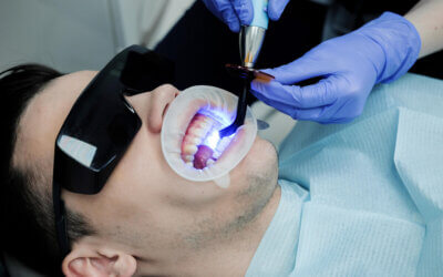 Top Questions to Ask Your Implant Dentist in Jacksonville, FL