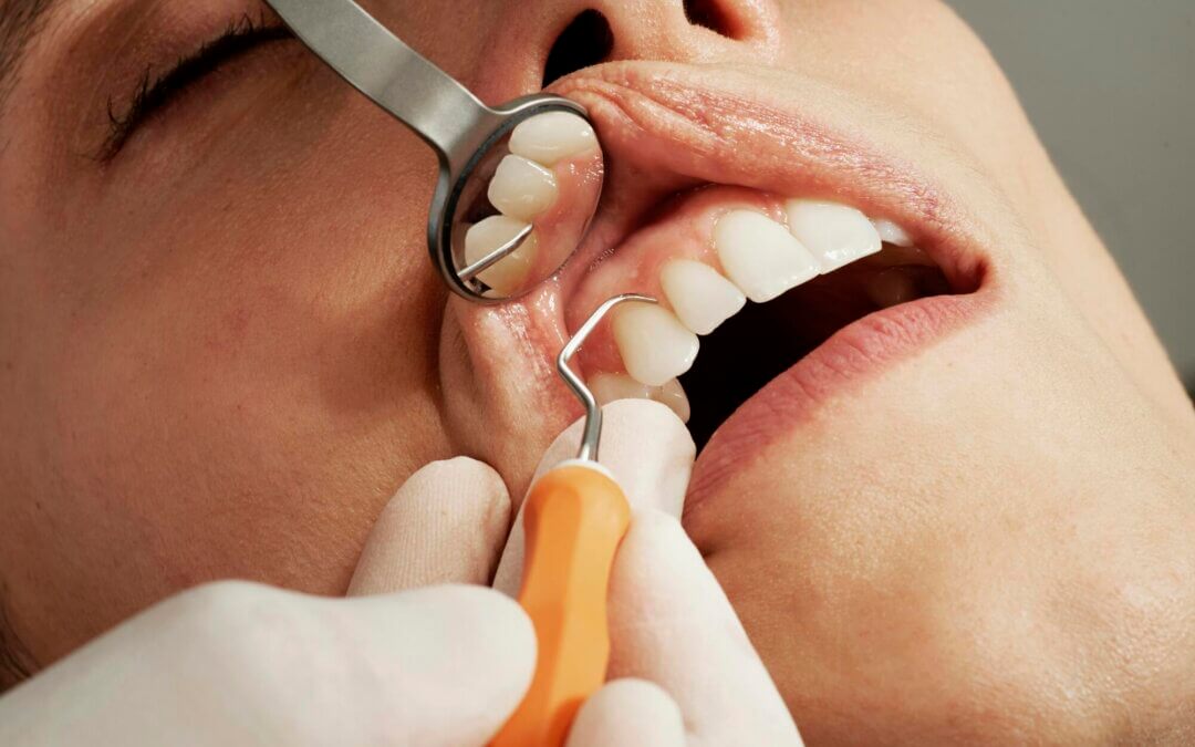 Reclaim Your Confident Smile by Eliminating the Crippling Shame of Past Dental Neglect
