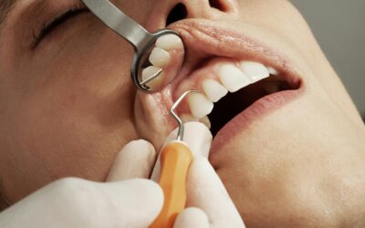 Reclaim Your Confident Smile by Eliminating the Crippling Shame of Past Dental Neglect
